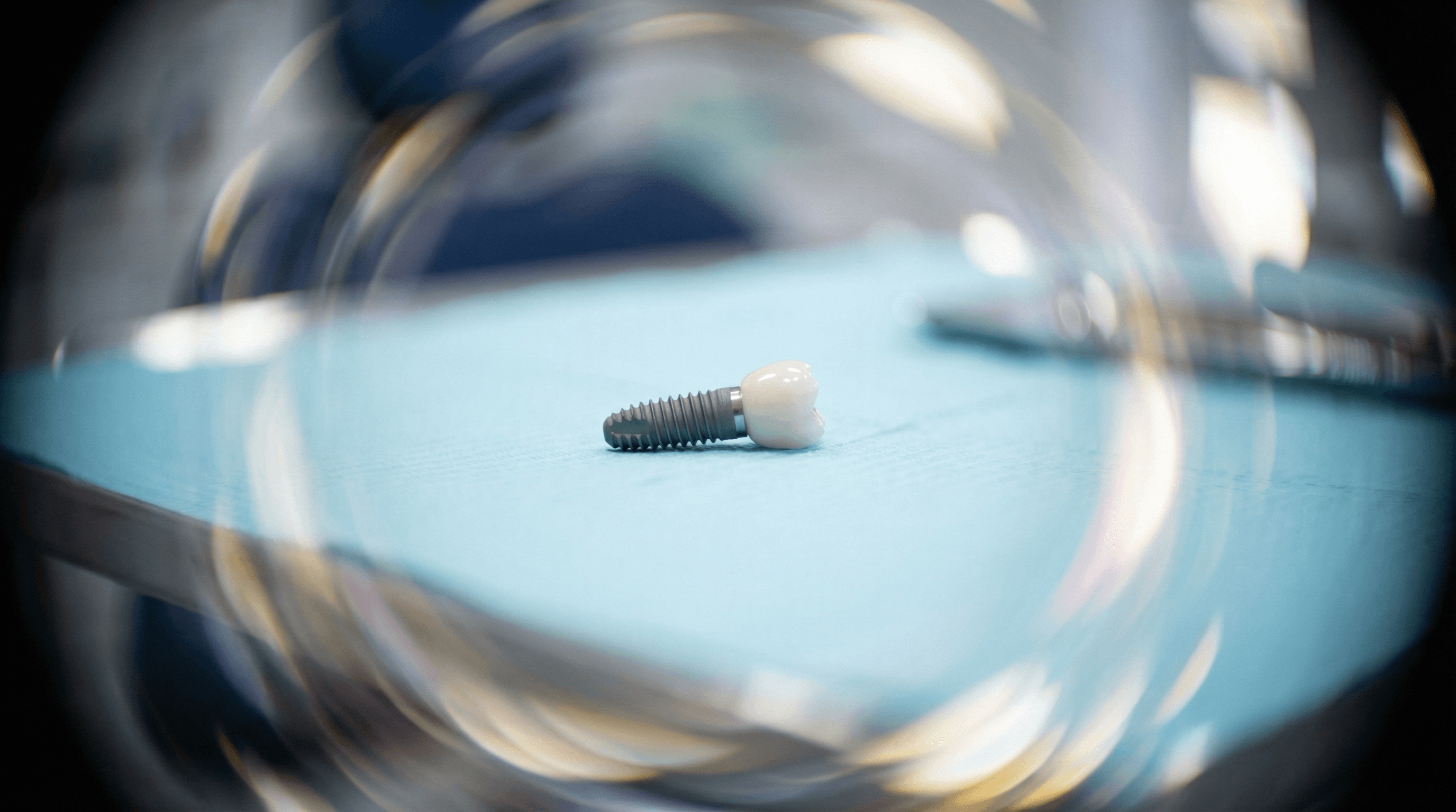 De ce să alegi un implant dentar pentru a înlocui un dinte