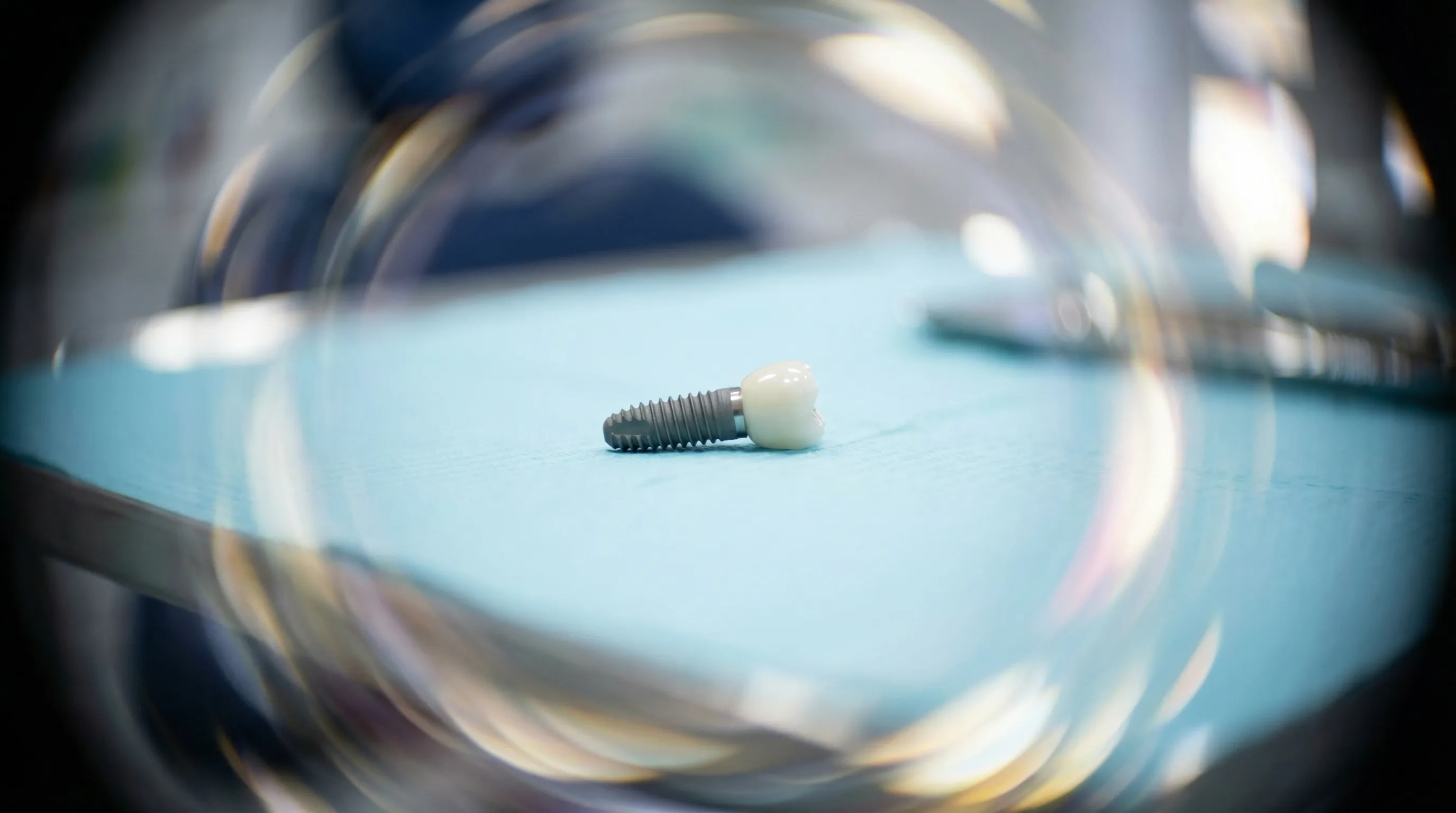 De ce să alegi un implant dentar pentru a înlocui un dinte